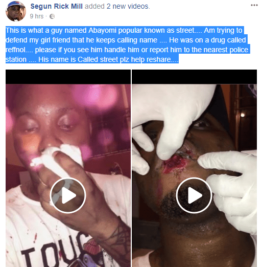Nigerian Man’s Lips Bitten Off While Defending Girlfriend From A Man (Photos)